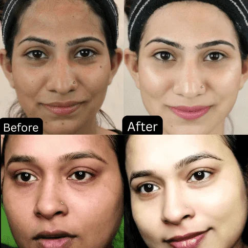 Zafrani Whitening Cream – Natural Glow Formula 🌼 (Buy 1 Get 1 FREE)